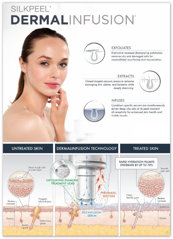 silkpeel Silkpeel dermalissage