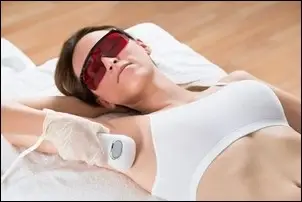 Laser permanent hårfjerning